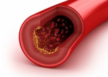 Pagrindinė vyresnių žmonių sveikatos problema – kraujotakos sistemos ligos