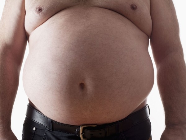 Tyrimas: miestų gyventojai maitinasi sveikiau, bet nutukimas vis tiek didėja