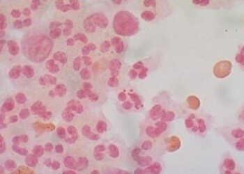 Kas yra meningokokinė infekcija?