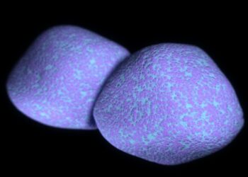 Dėl lėtinės ligos nusilpusį imunitetą atakuoja pneumokokinė infekcija