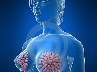 Sveika gyvensena saugant krūtų sveikatą