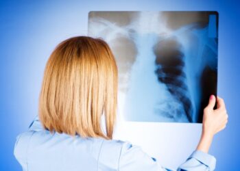 Tuberkuliozė. Dėl dezinfekcinių priemonių galima kreiptis į savivaldybės įstaigą