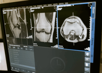 magnetinio rezonanso tyrimą